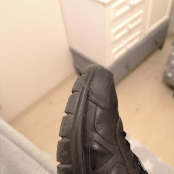 Skechers, Ayakkabısının Sorununu Kabul Etmiyor