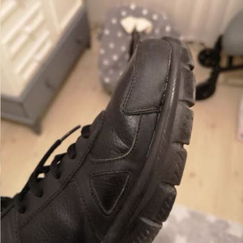 Skechers, Ayakkabısının Sorununu Kabul Etmiyor