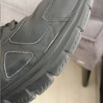 Skechers, Ayakkabısının Sorununu Kabul Etmiyor
