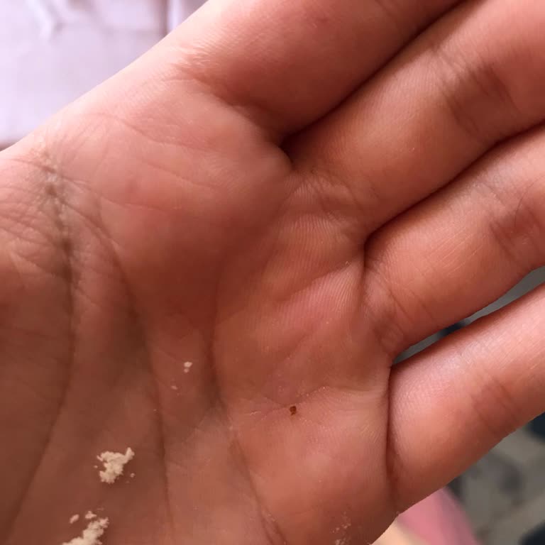 Aptamil Mamasından Çıkan Cisim