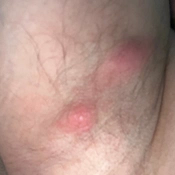 Rexona Pişmanlıktır!