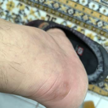 5000 TL'lik Ayakkabı Ayağımı Ve Çoraplarımı Mahvetti, SPX Mağazası İlgisiz!