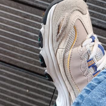 Skechers Ayakkabılarınız Yırtılıyor Ve Patlıyor
