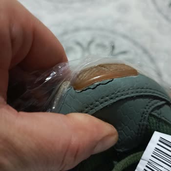 Skechers Ayakkabılarınız Yırtılıyor Ve Patlıyor