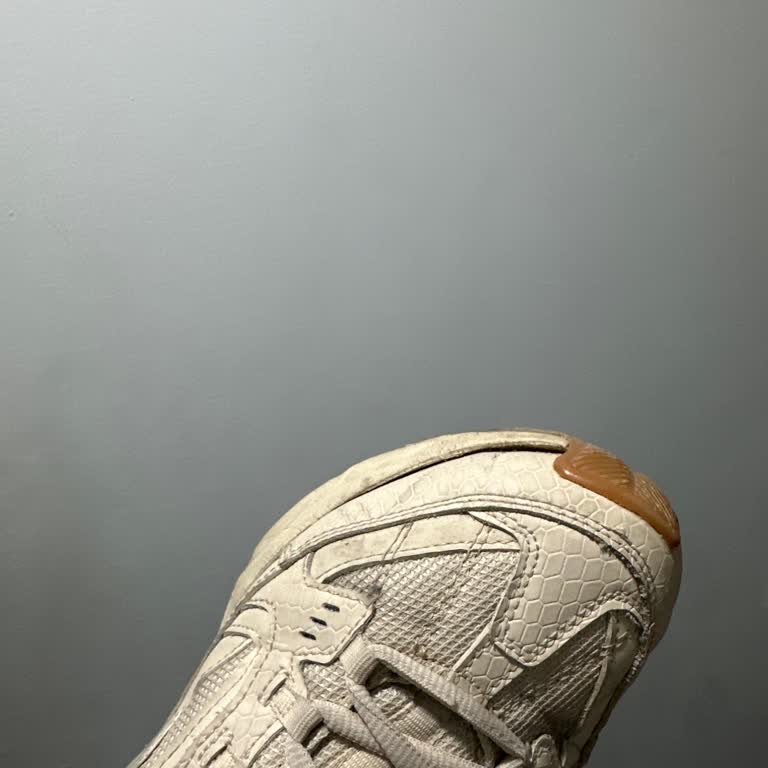 Skechers Stamina Ayakkabı Açıldı Ve Marka Malının Arkasında Durmuyor