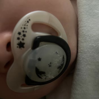 Mamajoo Emzik Plastik Deformasyonu