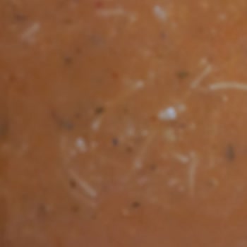 İzmir Katip Çelebi Üniversitesi Atatürk Eğitim ve Araştırma Hastanesi Hastane Yemeklerinin Kalitesi Ve Çeşitliliği Hakkında Şikayet