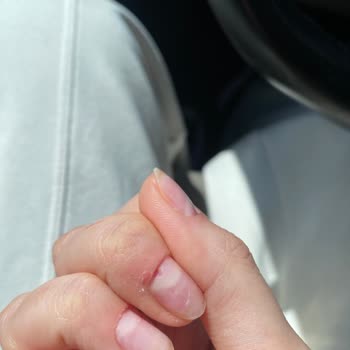 Galya Beauty Taşdelen Şubesi Tırnaklarımı Kanatarak Oydu!