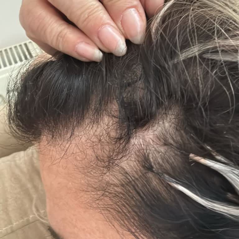 Hair Club Kalitesiz Hizmet