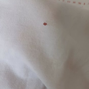 Bosch Çamaşır Makinesi Kıyafetlerimi Deliyor