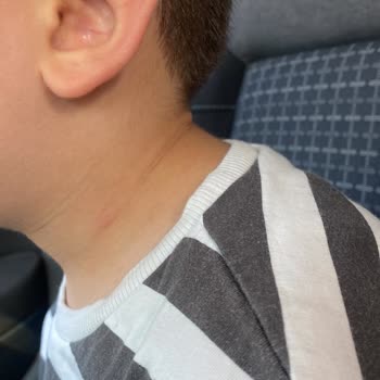 Berrak Anaokulu (Çengelköy) Şikayetçiyim