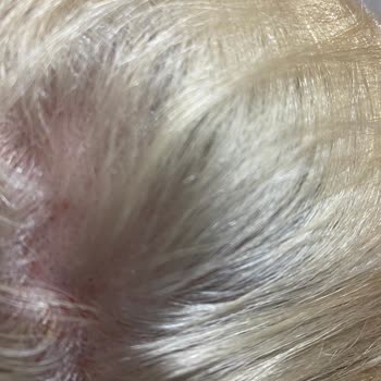 Saç Derim Yandı Palette