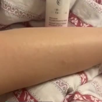 Yves Rocher Bright Botanical Serisi Alerjisi!