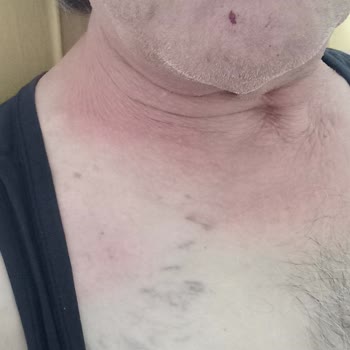 İzmit Seka Devlet Hastanesi Fizik Tedavi Bölümünden Şikayetçiyim!