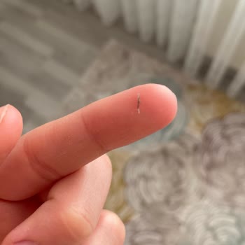 Begüm Kaynar Beauty Güzellik Merkezi Hatası!