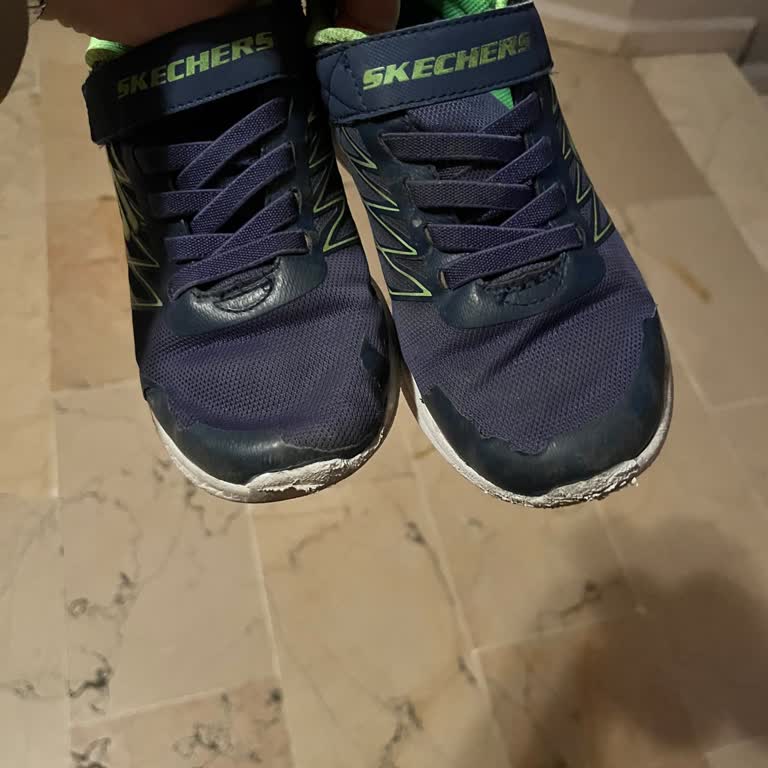 Skechers Ayakkabı Şikayeti Hak