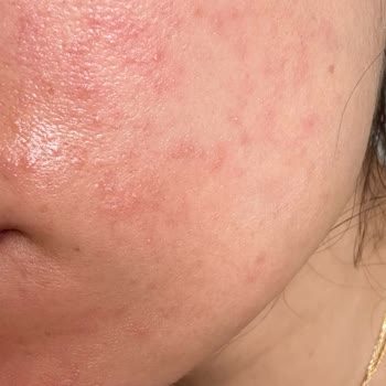 Cosmolog Orijinalliği Şüpheli Ürün Satıyor!