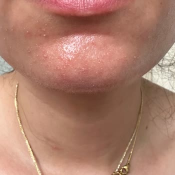 Cosmolog Orijinalliği Şüpheli Ürün Satıyor!