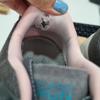 Skechers Ayakkabı Ayağımı Yara Yaptı