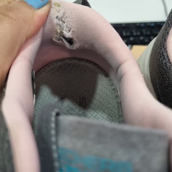 Skechers Ayakkabı Ayağımı Yara Yaptı