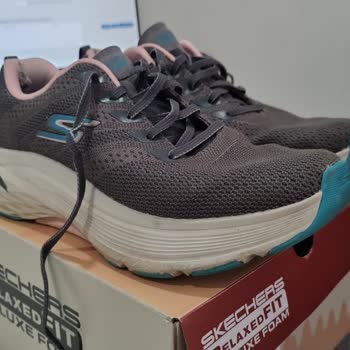 Skechers Ayakkabı Ayağımı Yara Yaptı