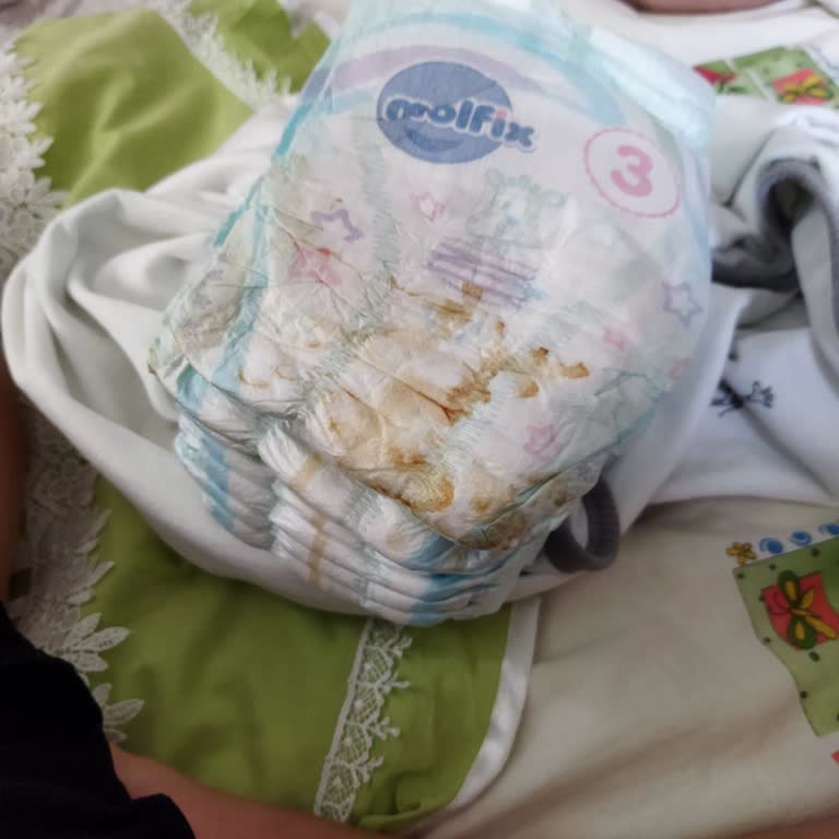Molfix Bebek Bezi Paketinden Kirli Çıktı