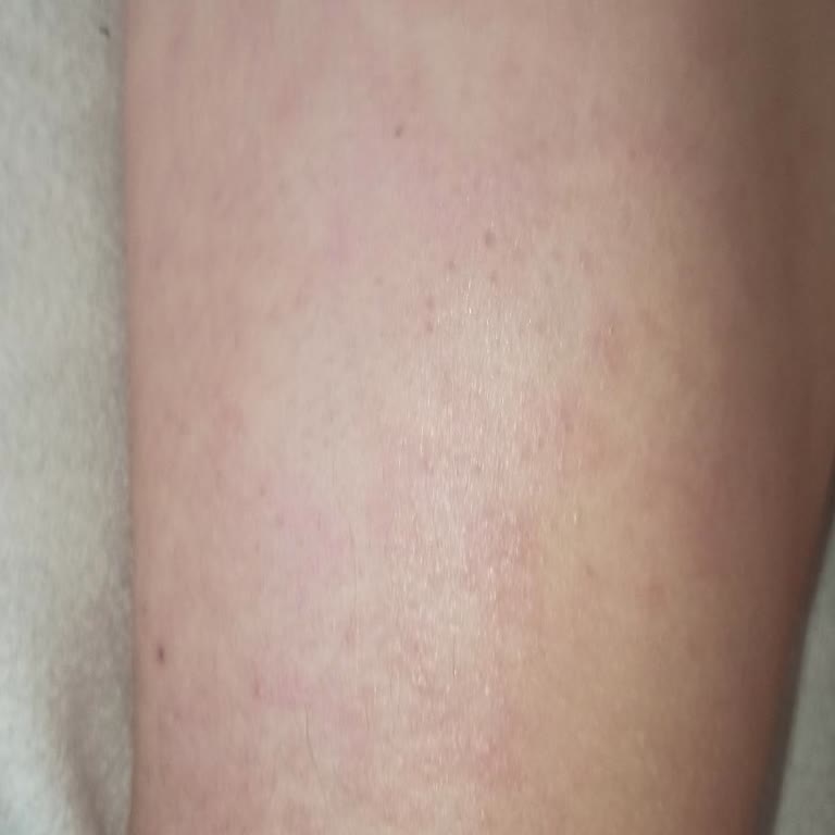 Amigo Cips Zehirlenmesi Belirtileri