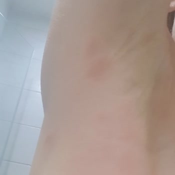 W_LAB Roll On Şikayet