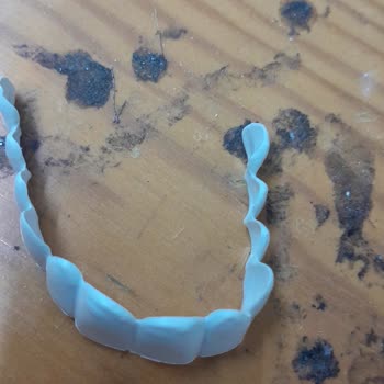 Dental Diş Protezi Diş Hekimi Hizmetleri İle İlgili Şikayet