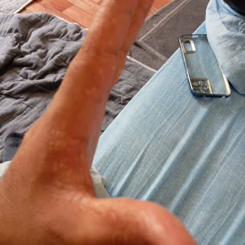 Hobby El Ve Ayak Kaşıntısı