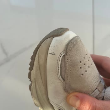 Puma Kadın Ayakkabının Sağ Ayağı Yırtık Ve Deforme