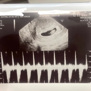 Mersin Toros Devlet Hastanesi Mezitli Semt Polikinliği