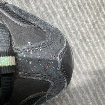 Skechers Ayakkabım Soyulmaya Ve Yıpranmaya Başladı.