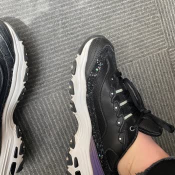 Skechers Ayakkabım Soyulmaya Ve Yıpranmaya Başladı.