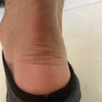 FLO Ayakkabı FLO'nun Ön Satış Güvensizliği