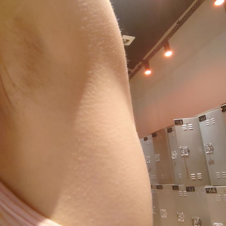 Aris Ezgi Doğan Polikliniği Laser Epilasyondan Leke Ve Yanık