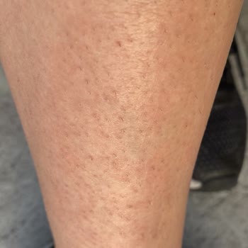 Jojomay Pronail Metrocity Paramı İade Etmiyor