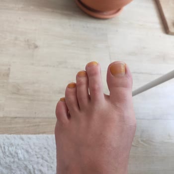 Note Cosmetics Note Flawless Matcha Rengi Tırnakları Boyaması Sorunu