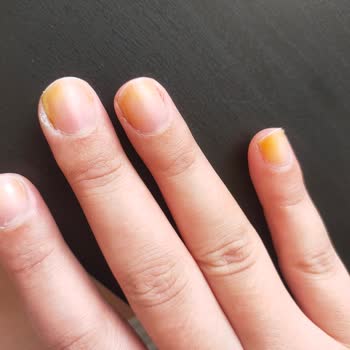 Note Cosmetics Note Flawless Matcha Rengi Tırnakları Boyaması Sorunu