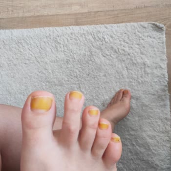 Note Cosmetics Note Flawless Matcha Rengi Tırnakları Boyaması Sorunu