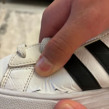 Adidas Spor Ayakkabı Yırtılması Ve Tadilat Yapılmaması