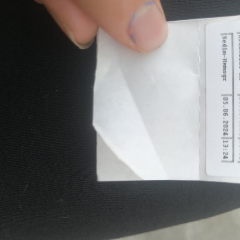 Isparta Şehir Hastanesi Kan Sonuçları Geç Çıkması