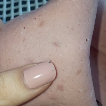 Pınar Et ve Süt Hindi Salamında Görülen Siyah Noktalar