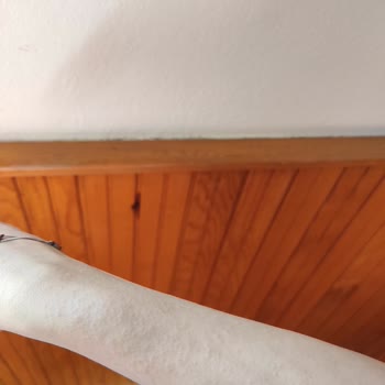 Nivea Güneş Kremi Alerji