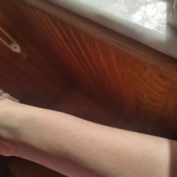 Nivea Güneş Kremi Alerji