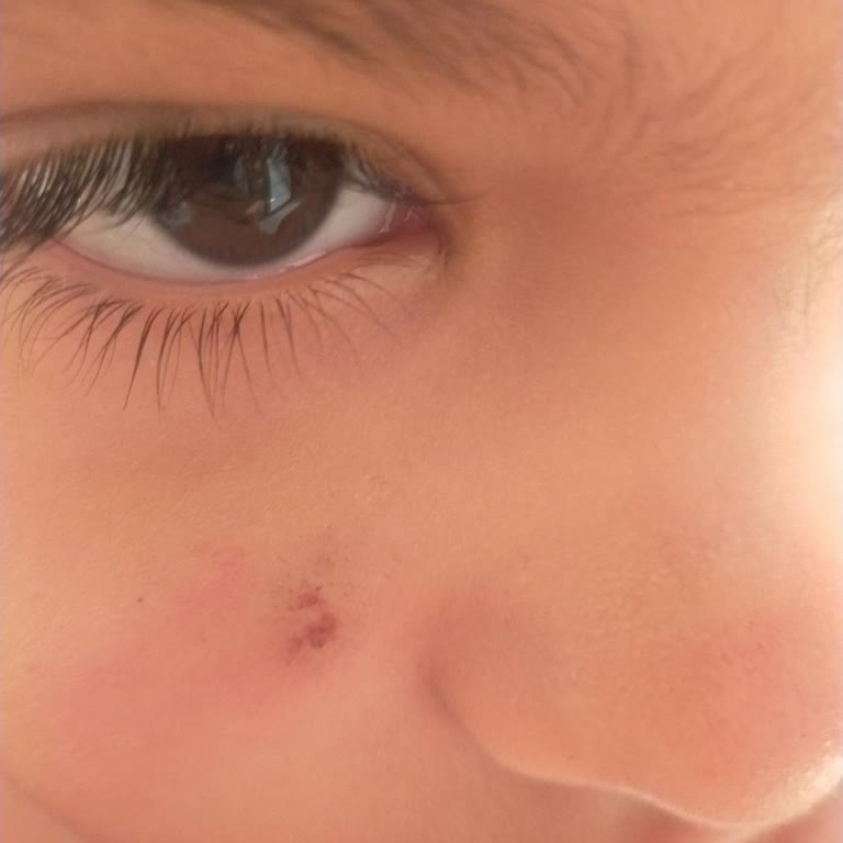 Garnier 50 İle Cildimiz Yandı