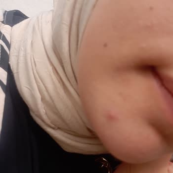 Eki aç