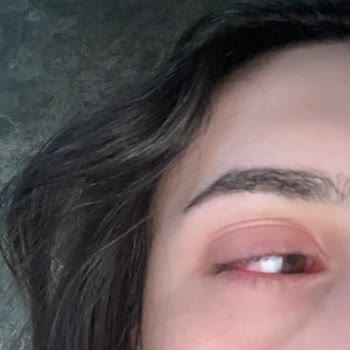 Watsons Çalışanının Yüzümden Göz Sağlığımı Kaybettim