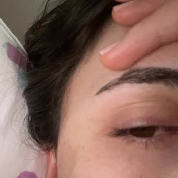 Watsons Çalışanının Yüzümden Göz Sağlığımı Kaybettim