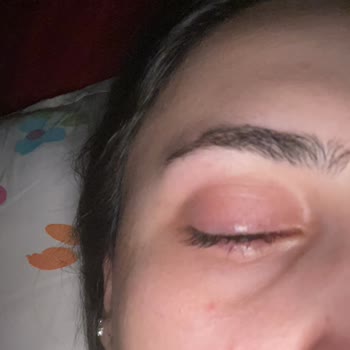 Watsons Çalışanının Yüzümden Göz Sağlığımı Kaybettim